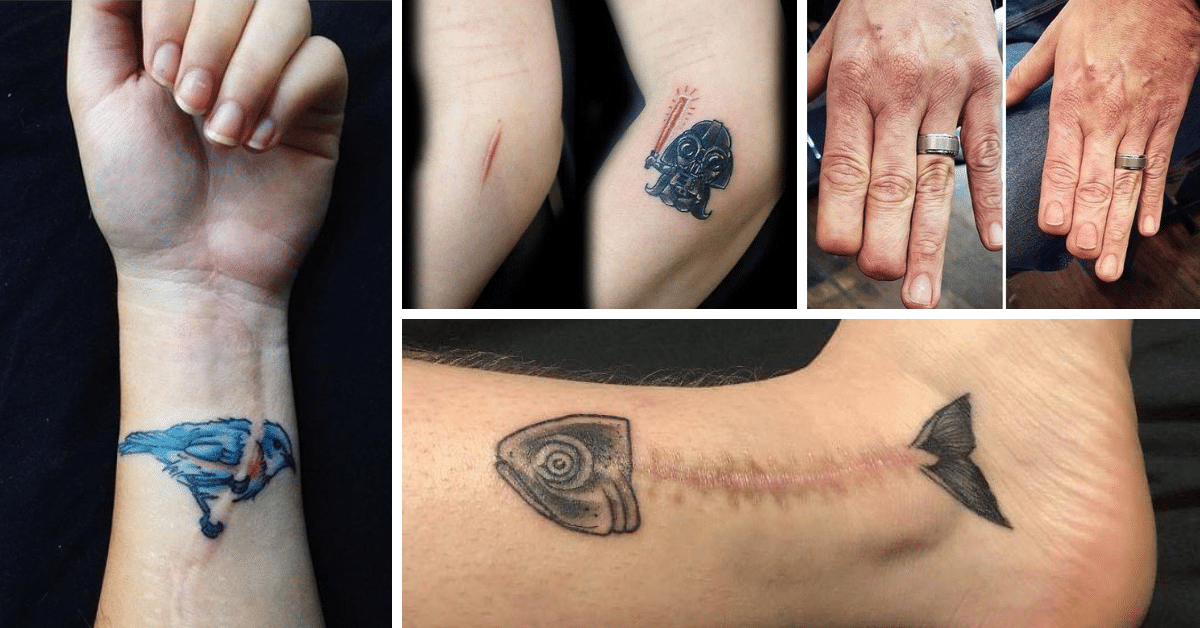Tatuagens para disfarçar cicatrizes